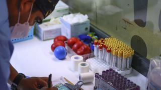 Ministerio de Salud y Gobierno de la India analizan posibilidad de producir vacunas en el Perú