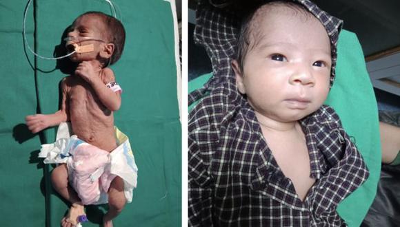La bebé fue llevada al hospital en estado crítico, pero ahora está saludable. (Foto: Dr. Ravi Khanna, vía BBC Mundo).