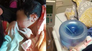 México: Indignación por usar bidón de agua como incubadora para recién nacida