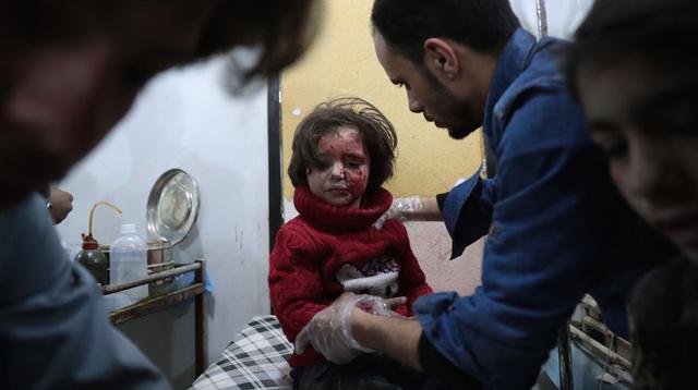 Siria: El terrible rostro de una guerra que lleva más de 6 años - 6