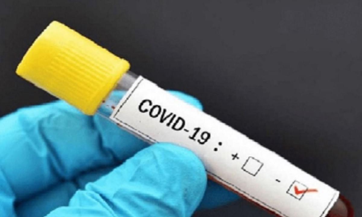 La cifra de muertos por Covid-19 en el Perú se incrementó a 47 el miércoles 1 de abril, día 17 del estado de emergencia decretado por el Gobierno | GEC