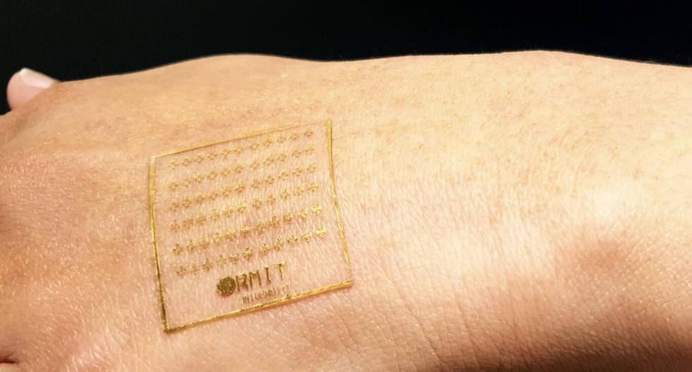 What are e-skins and why could they be the wearable of the future?