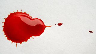 “La hemofilia no debe obligar al paciente a vivir en una burbuja” | VIDEO