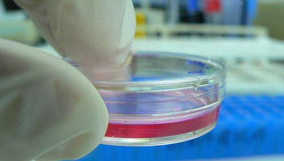 Crean prueba de sangre que puede detectar el cáncer de colon