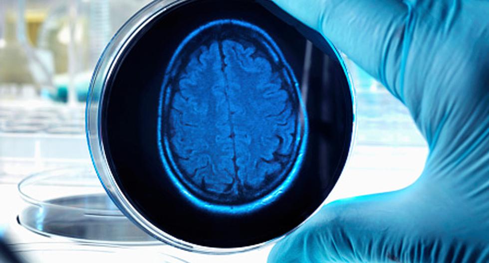 Científicos asocian la demencia del alzheimer con la producción irregular de óxido nítrico en el cerebro. (Foto: Getty Images)