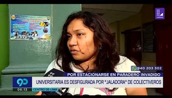 Ruth Ruiz Seña contó que Briggitte Pozo Agurto la atacó con uñas en sus brazos y rostro (Captura: Latina)