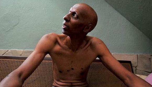 Cuba: Disidente Guillermo Fariñas inicia nueva huelga de hambre