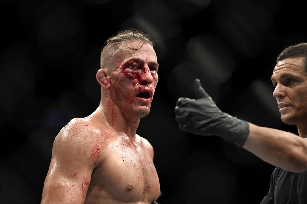 UFC 249: Niko Price terminó con un impactante corte en el ojo y perdió por nocaut ante Vicente Luque | Fot: AP/EFE/AFP/Reuters