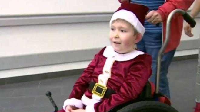 Noah nació con solo el 2% del cerebro.