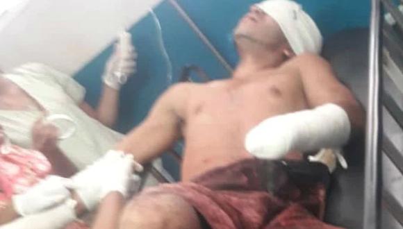 Mutilaron las manos, sacaron los ojos y cortaron la lengua a soldado en mina de Venezuela. Foto: Twitter @PableOstos