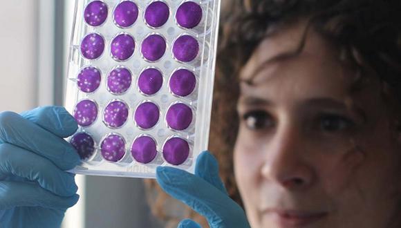 Una de los miembros del equipo, Meriem Bekliz, observa una de las placas usadas para determinar la capacidad de neutralización de los anticuerpos. (Foto: EFE/HUG-UNIGE)