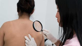 Liga Contra el Cáncer inicia campaña de despistajes contra el cáncer de piel