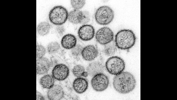 Micrografía electrónica de transmisión del virus. (Foto: CDC/Cynthia Goldsmith, dominio público)
