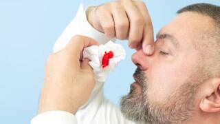 Trucos para detener el sangrado nasal con ingredientes básicos