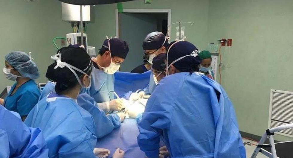 Médicos estudian cómo separar a 2 siameses unidos por la cabeza. | Foto: Facebook / Captura