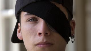Lesiones oculares y ceguera, marcas indelebles de la represión en Chile | FOTOS Y VIDEO 