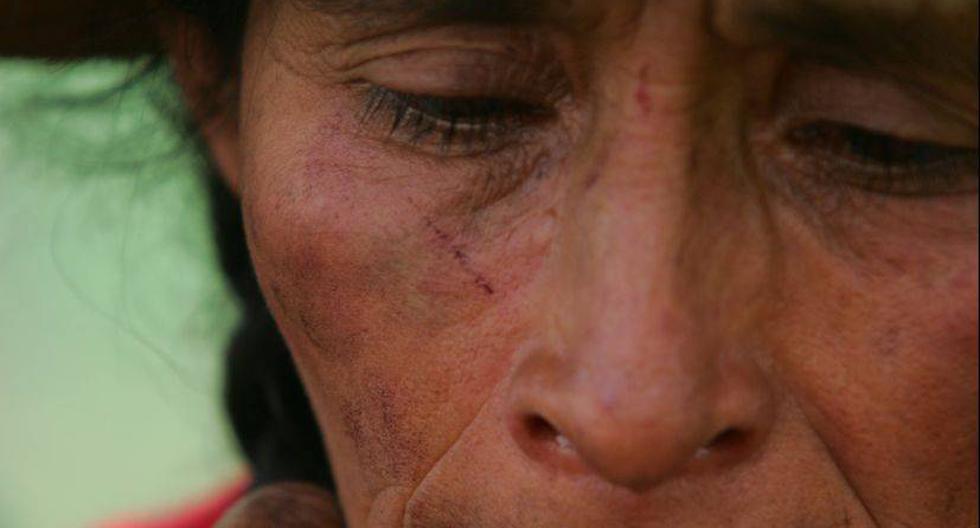 Siete de cada 10 mujeres peruanas es víctima de violencia emocional. (Foto: USI)