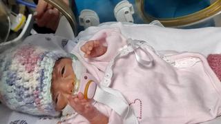 La historia de Olivia, la bebé más pequeña de América Latina: pesó 330 gramos al nacer