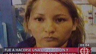 Una mala liposucción le dejó un agujero en abdomen a mujer