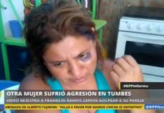 Tumbes: mujer que fue golpeada por su pareja, ahora lo justifica