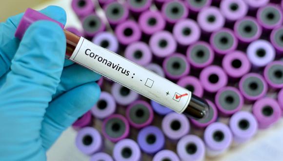 El virus sigue avanzando a otros continentes pues ya se confirmó el primer caso de coronavirus en América Latina (Foto: EFE)