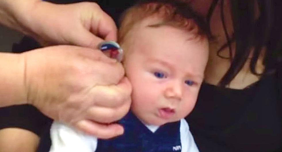 Lachlan Lever de solo 7 semanas de edad, estaba apunto de percibir de otra manera el mundo. (Foto: Captura de YouTube)