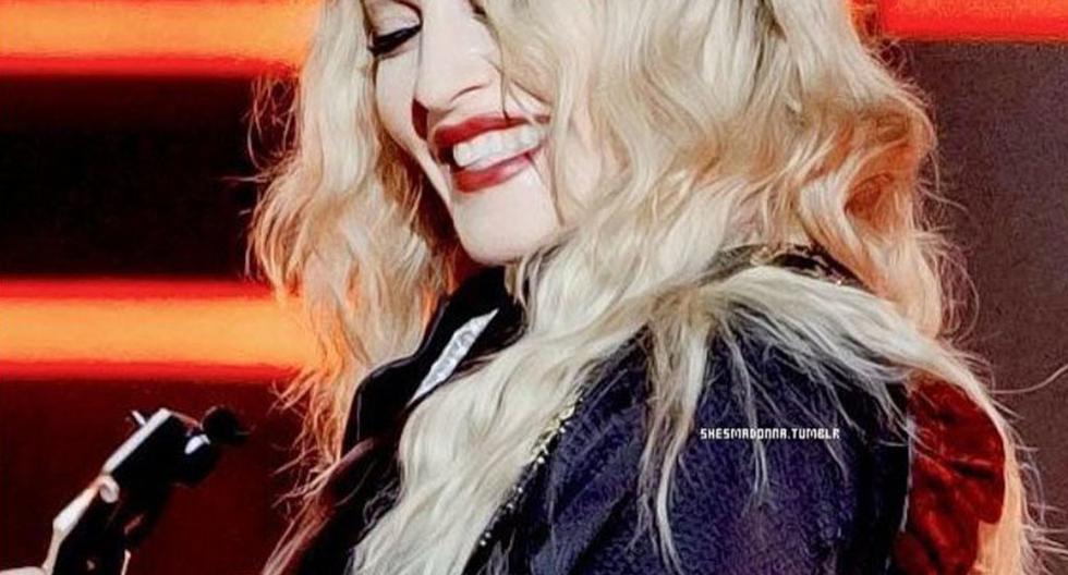 Madonna se somete a un costoso tratamiento para quitarse las arrugas. (Foto: Instagram oficial)