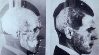 La segunda muerte de Josef Mengele, el sanguinario médico nazi que se ocultó en Brasil