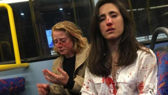 La uruguaya Melania Geymonat y su novia Chris rueron atacadas por al menos cuatro hombres las acosaron, las golpearon y les robaron antes de desaparecer.