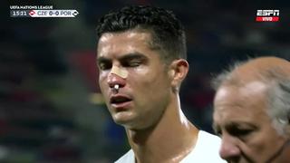 Terminó sangrando: Cristiano Ronaldo chocó con arquero rival y se llevó la peor parte | VIDEO