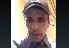 Henrique Capriles: ¿cuál es el extraño mal que sufre su rostro?