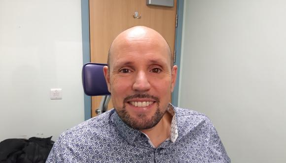 Steve Verze con su nuevo ojo protésico impreso en 3D. (Foto: NIHR)