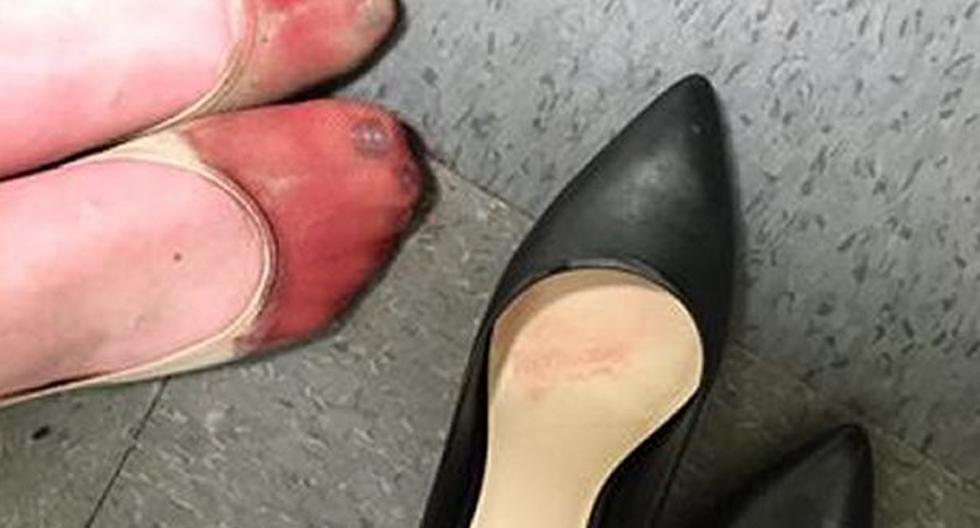 Mesera termina con los pies ensangrentados por usar tacones durante sus horas de trabajo. (Foto: Facebok Nicola Gavins)