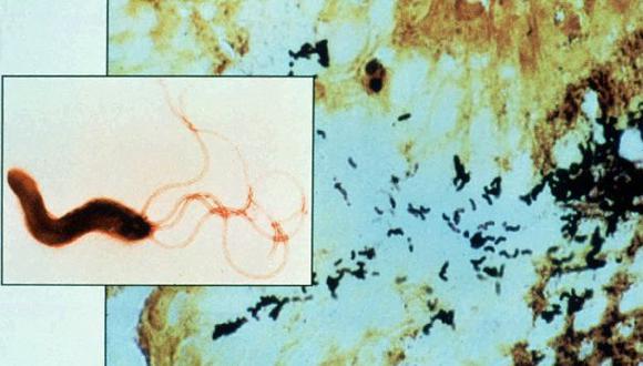 Imagen de la bacteria &#039;Helicobacter pylori&#039;, que est&aacute; considerada por la OMS como un microorganismo de alta peligrosidad. (Foto: AP /Health Sciences Center-University of Virginia)