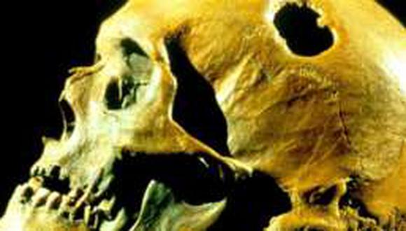 ¿Por qué nuestros antepasados se perforaban el cráneo?