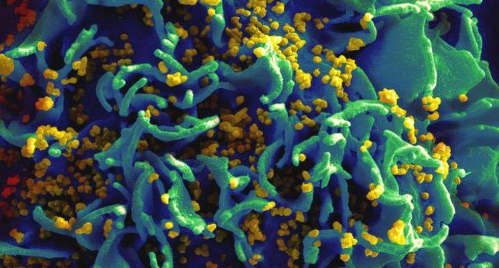 Una célula infectada con el VIH. (Foto: NIAID/Flickr)