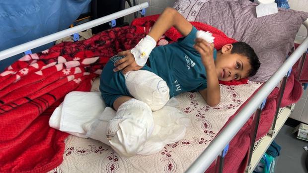 Yassin al Ghalban, de 11 años, perdió las piernas en un bombardeo de la aviación israelí. 