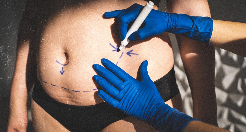 Almost 90 plastic surgeons are licensed or banned in Peru: Here you can search and check it |  Malpractice |  CMP |  Millie doll |  Maricielo Effio |  ECDATA