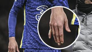 Duele verlo: así terminó el dedo de Kai Havertz en el Chelsea-Tottenham | VIDEO 