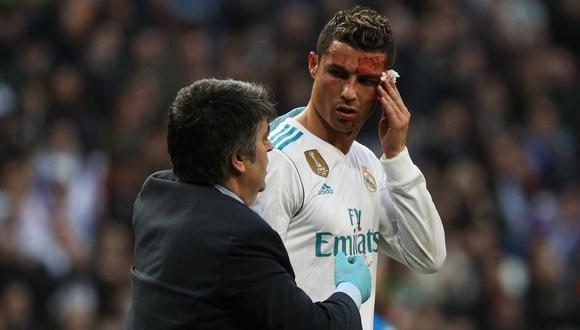 Cristiano terminó ensangrentado tras marcar doblete con el Madrid. (Foto: AFP)