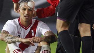 Perú perdió ocho puntos en Lima y hoy los añora más que nunca