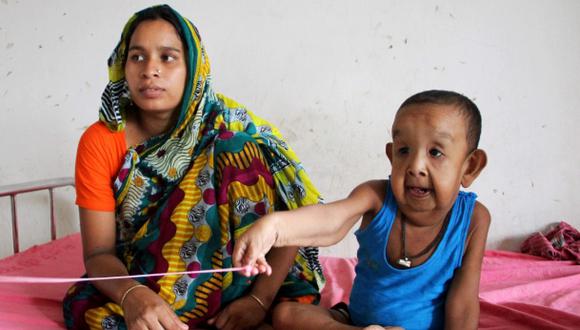 Someten a "Benjamin Button" de Bangladesh a exámenes médicos