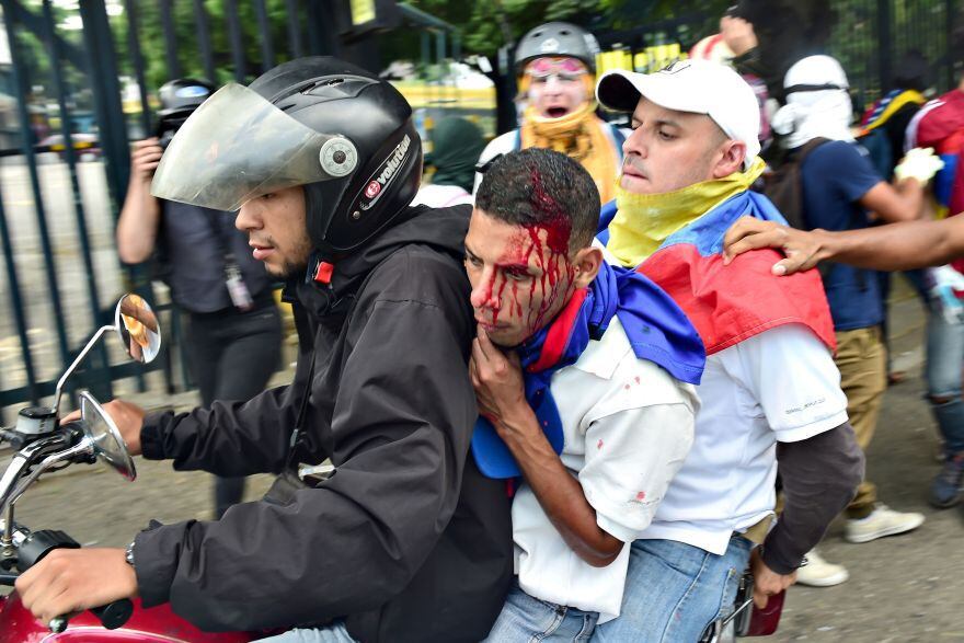 La crisis política, económica, social y humanitaria que vive Venezuela la ubica como la más violenta de Sudamérica. (Foto: AFP)