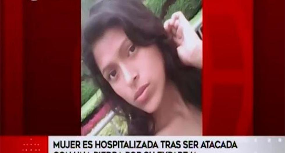 Lima. Joven sufrió heridas tras ser atacada por su expareja con una piedra en un paradero de Acho. (Foto: América Noticias)