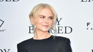 Nicole Kidman luce irreconocible por exceso de bótox