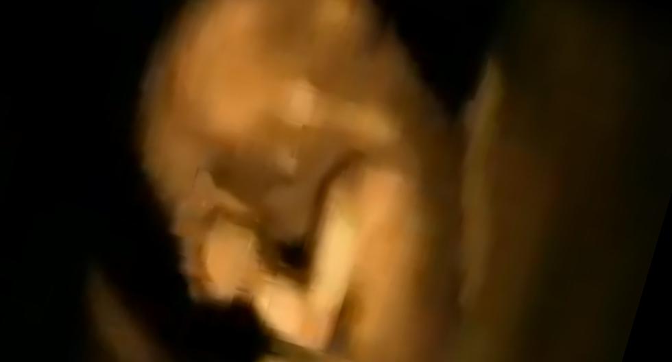 Ecografía 4D de bebé bailarín en el vientre de su madre es viral. (Foto: Facebook)