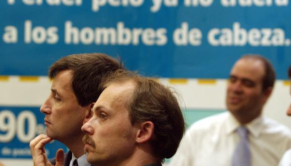 ¿Una nueva alternativa ante la caída del cabello? (Foto: EFE)