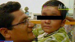 Niño con "piel de mariposa" retornó a Lima tras recibir tratamiento en Chile