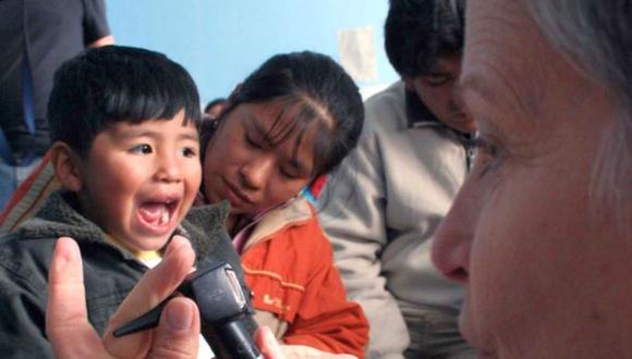 Tumbes: 80 niños con labio leporino fueron operados gratis