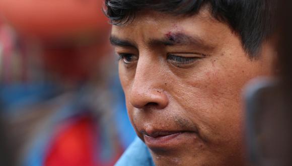 Édison Vargas es acusado de haber causado un accidente de tránsito, la noche del viernes, contra la PNP en el sector de Manantiales, en el ingreso a Las Bambas (Foto: Antonio Álvarez)